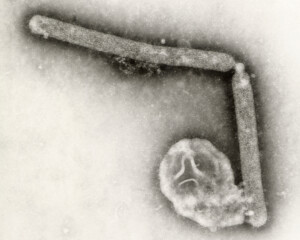 un premier cas humain de grippe aviaire confirme en lombardie le premier dans lue